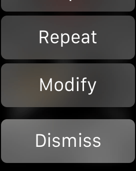 Notification actions in a WatchKit app